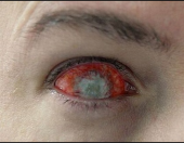 Склеры "Зомби" Склеры "Зомби"